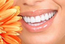 Top 6 Nguyên nhân khiến răng lung lay, rụng sớm và cách phòng ngừa