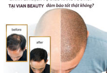 Đánh Giá Dịch Vụ Điêu Khắc Tóc Hói Tại Vian Beauty, Có Đáng Tin Cậy Không? 5