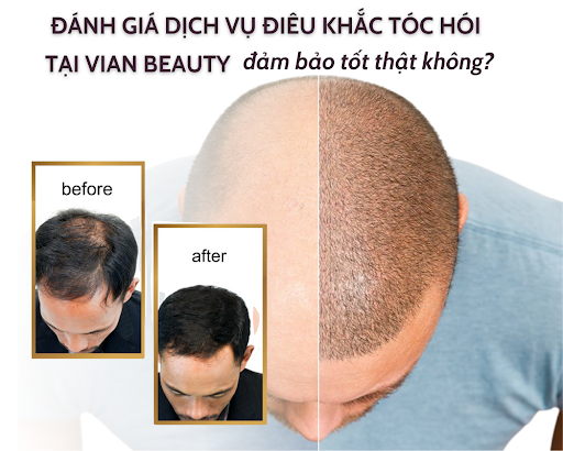 Đánh Giá Dịch Vụ Điêu Khắc Tóc Hói Tại Vian Beauty, Có Đáng Tin Cậy Không? 1