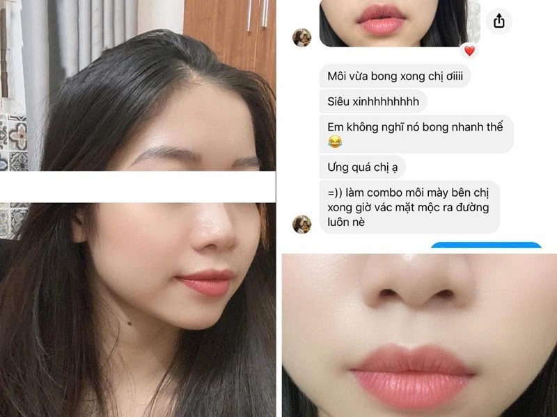 Có Nên Phun Xăm Mày, Môi Tại Vian Beauty? 8