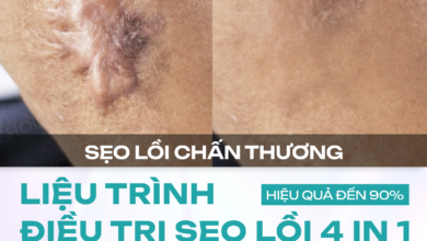 Review chất lượng điều trị sẹo lồi tại Dr. Choice Clinic 9